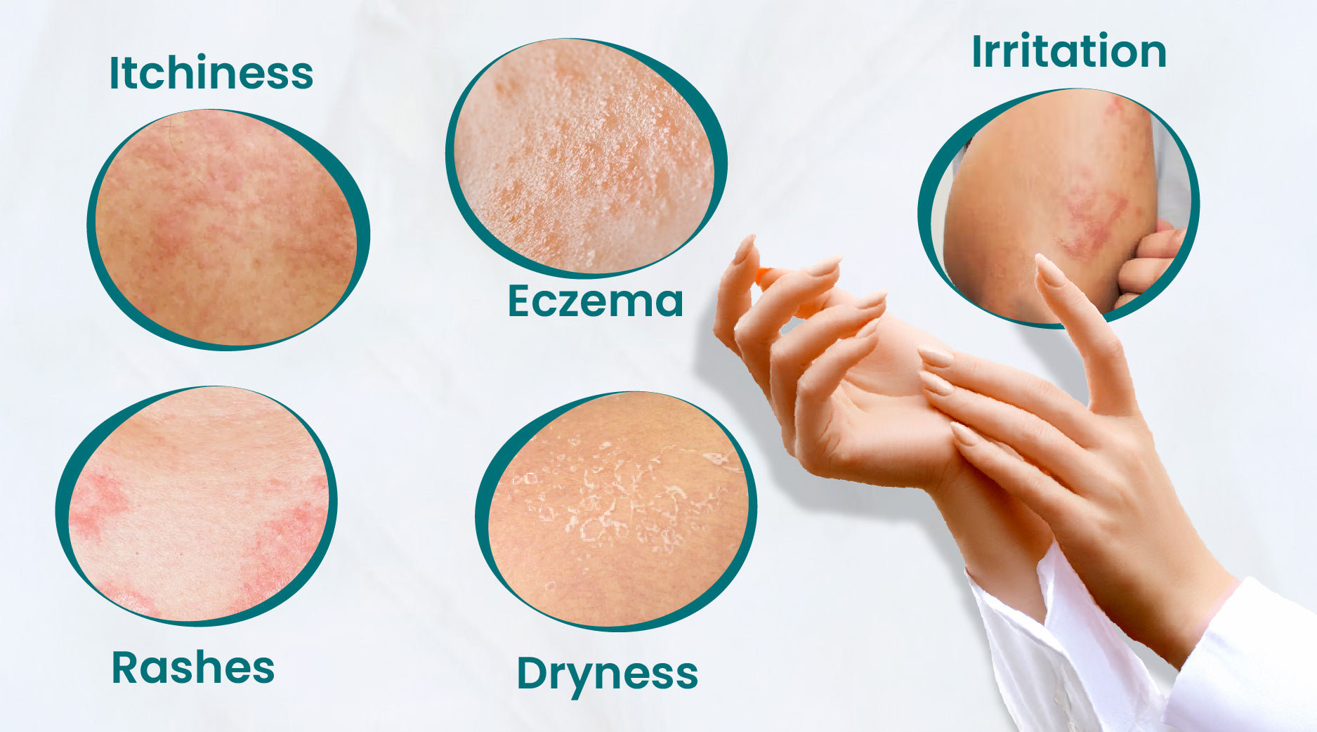 Sensitive Skin Rashes Understanding Sensitive Skin & How to Care for It